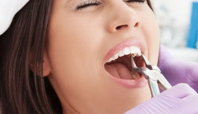 Diş çekimi sonrası yemek